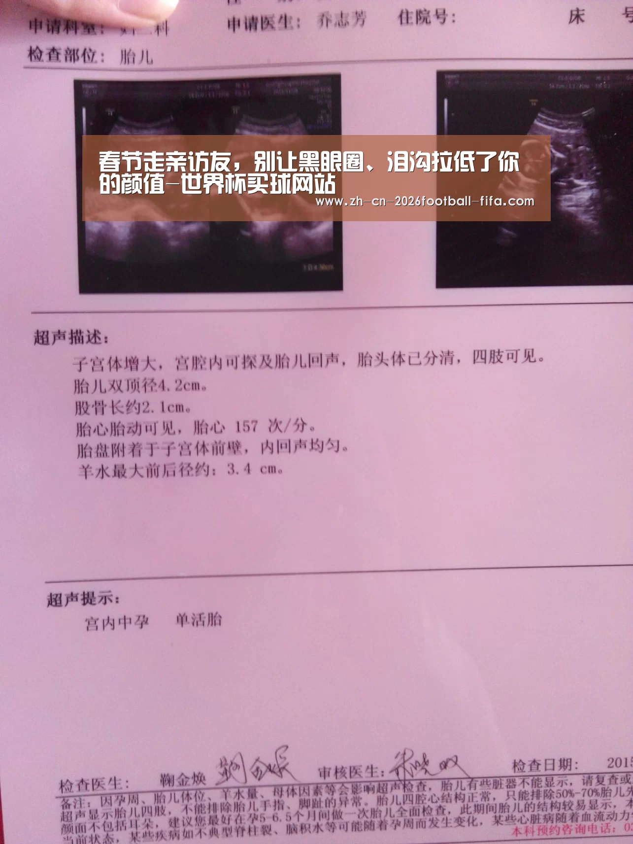 世界杯买球网站
